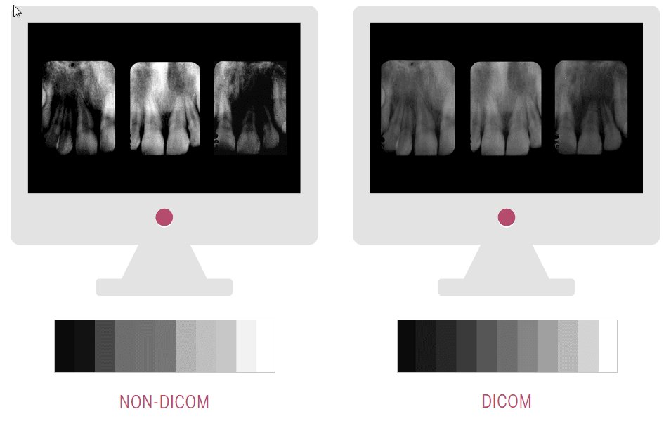 Monitor mit NON-DICOM und DICOM im Vergleich