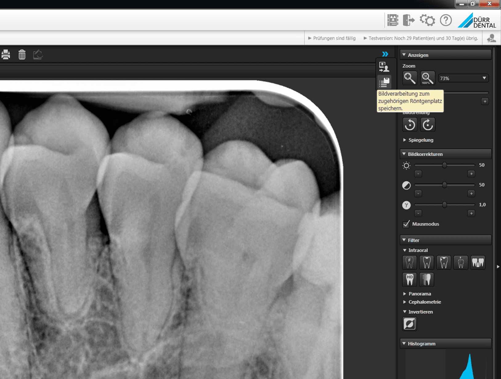 Bilddarstellung anpassen für eine optimale Darstellung Ihrer Röntgenbilder.