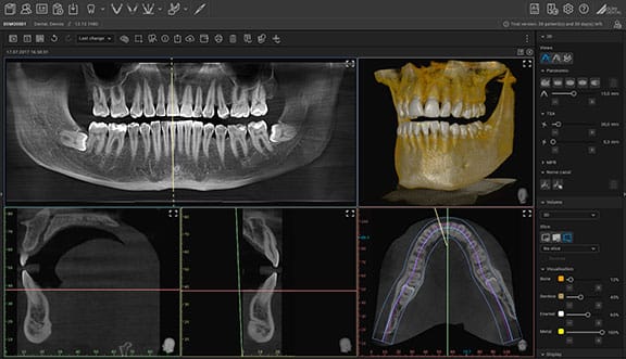 AI-gestützte Panoramadarstellung Röntgenaufnahme