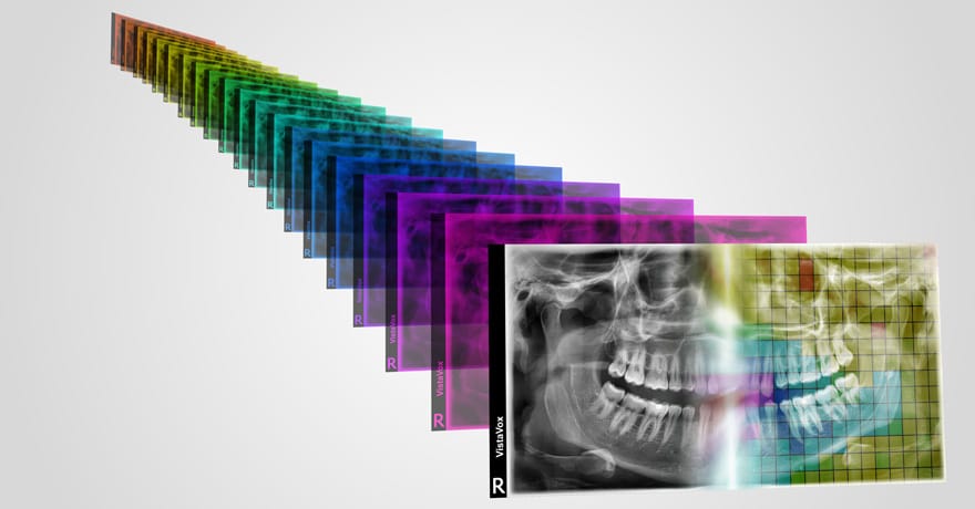 Automatic selection of specific image areas with S-Pan technology