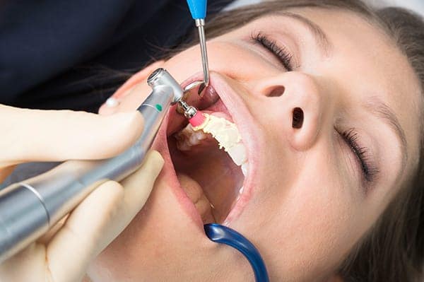 Die Zahnpolitur ist ein fester Bestandteil der professionellen Zahnreinigung.