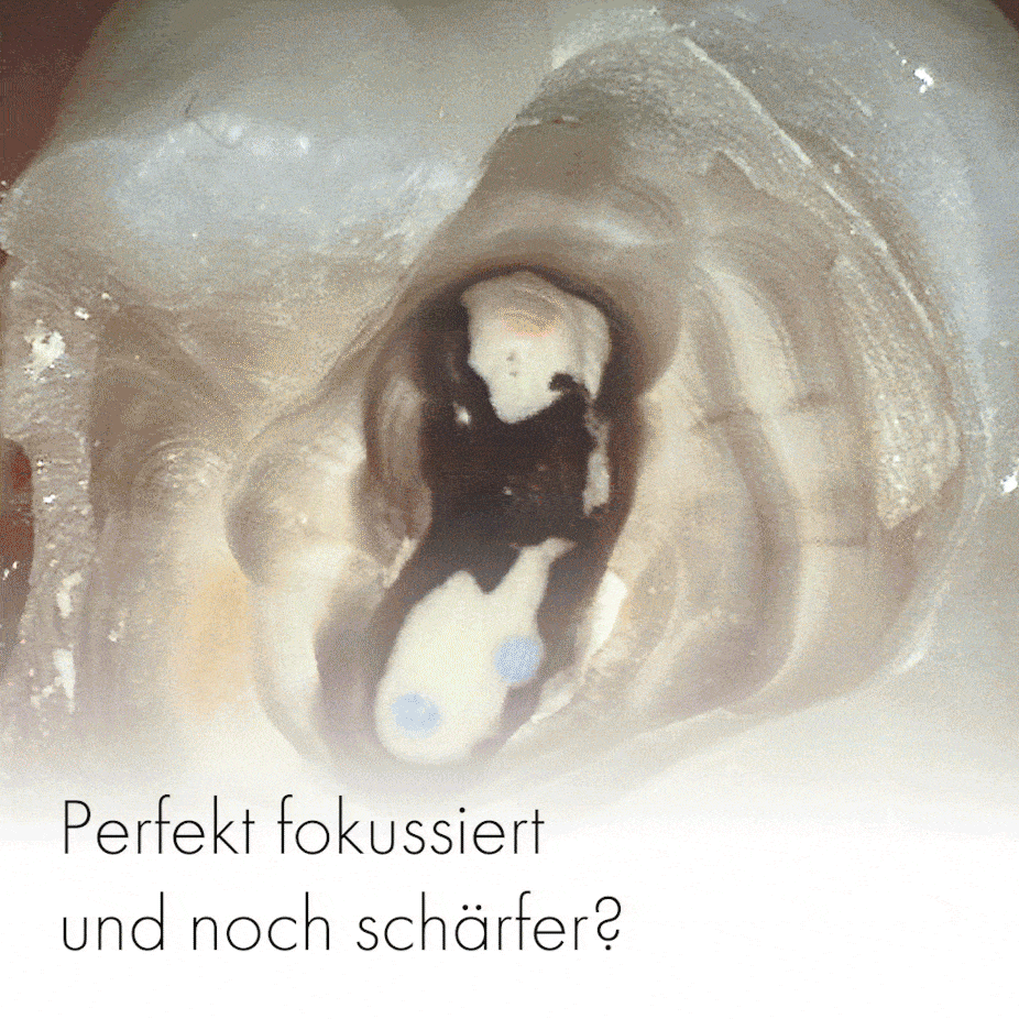 Intraoralkamera Aufnahmen mit HD Qualität Intraoralkamera Aufnahmen mit HD Qualität